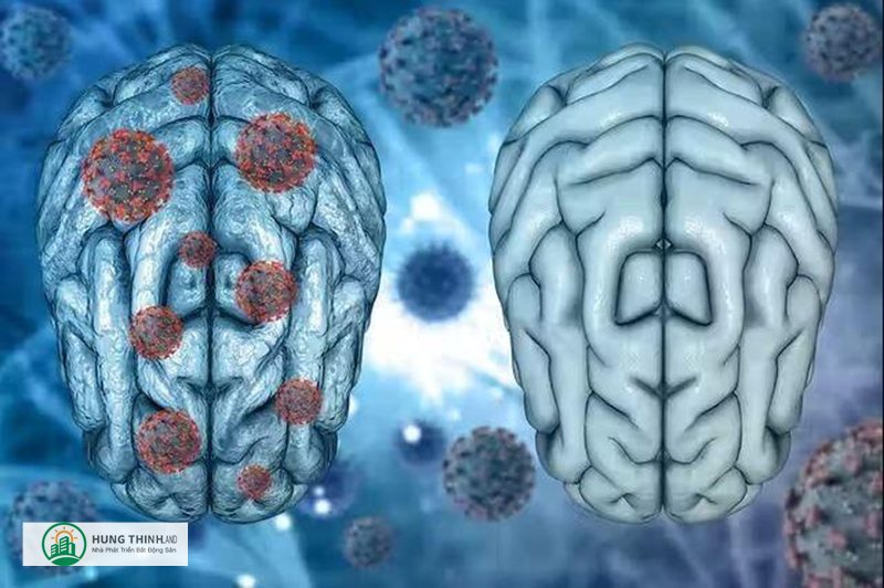 Triệu chứng covid - Đau ngực, khó thở và nhịp thở nhanh Triệu chứng covid - Đau ngực, khó thở và nhịp thở nhanh